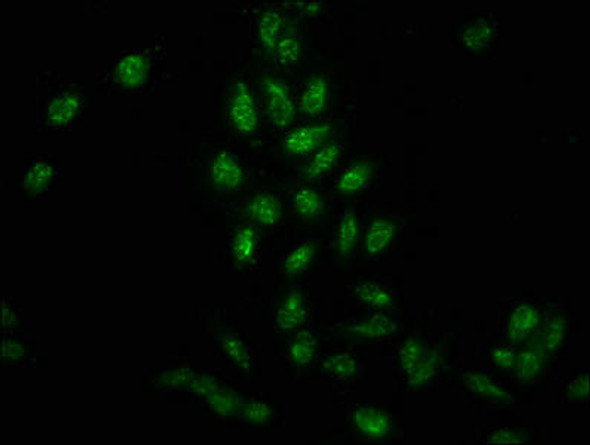 Phospho-HIST1H3A (Y41) Antibody (PACO57631)