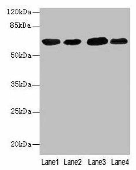 ESR1 Antibody (PACO33020)