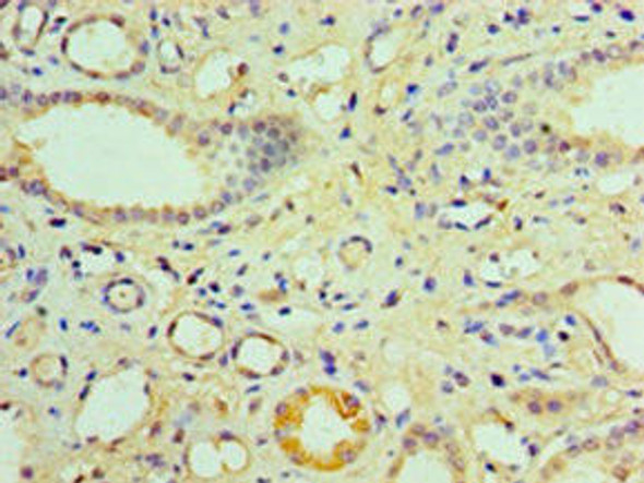 NR1I3 Antibody (PACO33292)