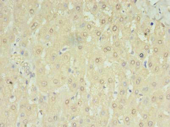 MRM3 Antibody (PACO40842)