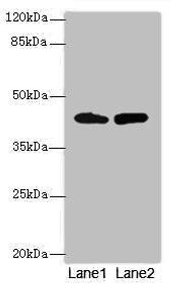 NMUR1 Antibody (PACO41942)