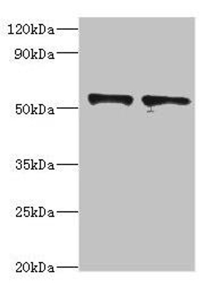 SPTLC1 Antibody (PACO42899)