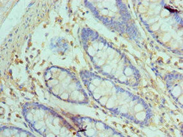 GOLM1 Antibody (PACO43093)