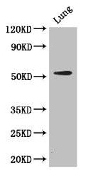 CORO1A Antibody (PACO48302)