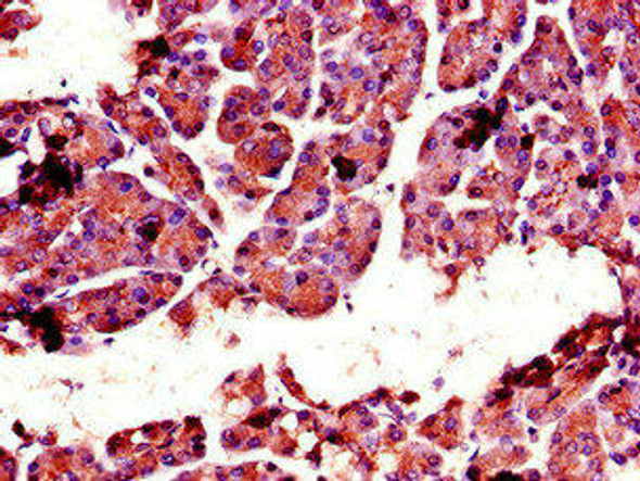 CTRL Antibody (PACO48310)