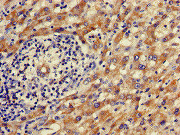 ALDH9A1 Antibody (PACO48830)