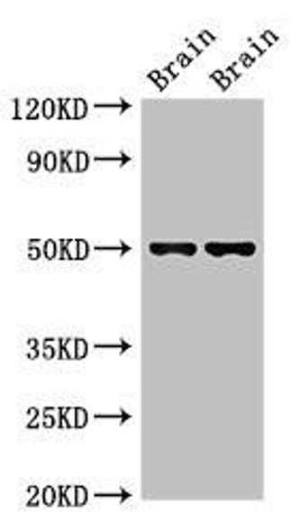 Gfap Antibody (PACO51538)