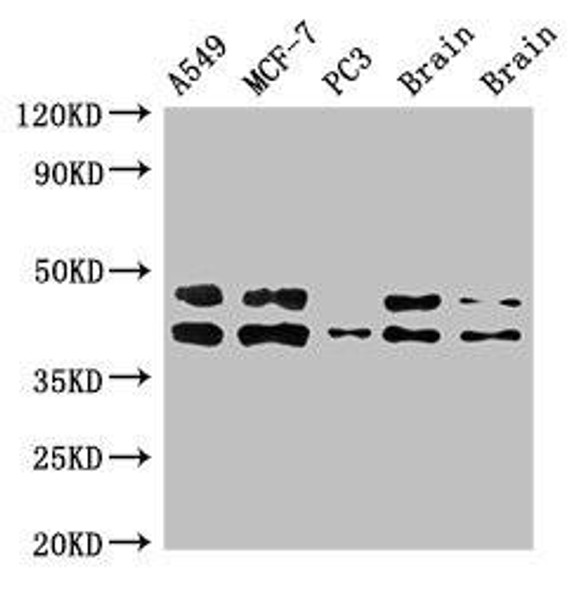 PRKACB Antibody (PACO51858)