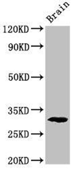 Pdxp Antibody (PACO53714)