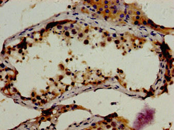 RBP1 Antibody (PACO54382)