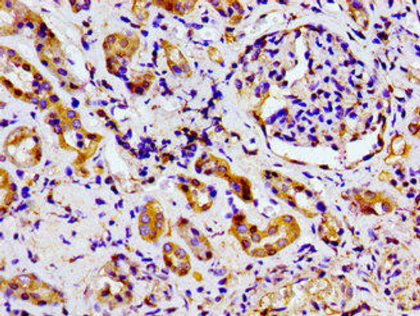 MARK2 Antibody (PACO55190)