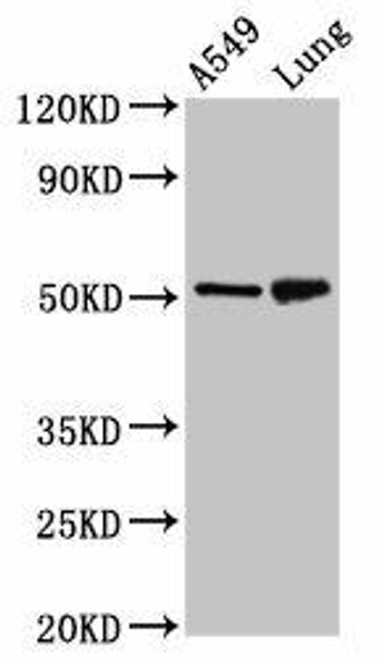 IRX3 Antibody (PACO55558)