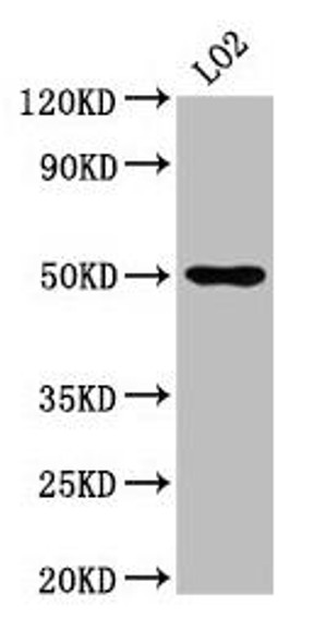 AGXT2 Antibody (PACO57460)