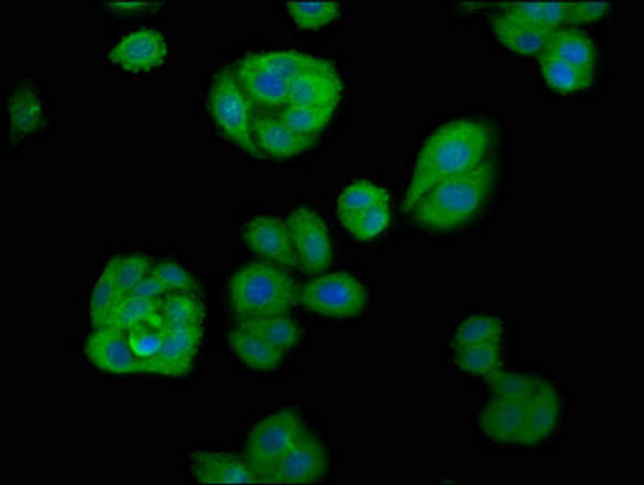 APOBEC1 Antibody (PACO57660)