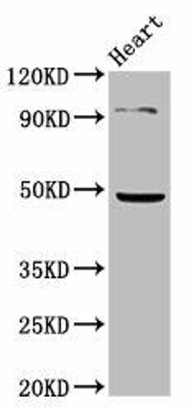 KCNJ5 Antibody (PACO57824)