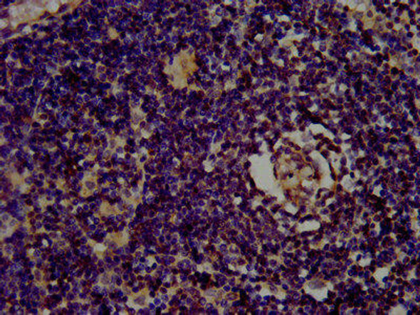 CLC Antibody (PACO58060)