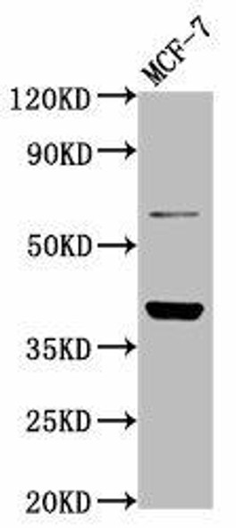 LAPTM4B Antibody (PACO58252)