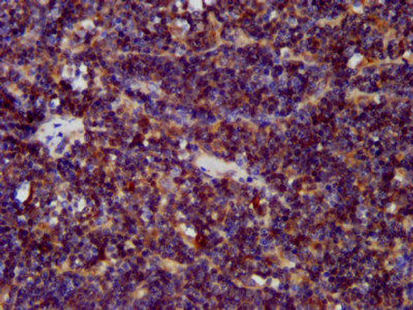 CDCA7L Antibody (PACO58404)