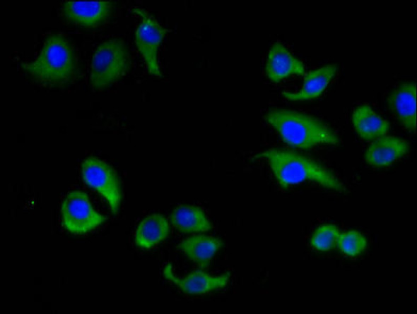 ABCC6 Antibody (PACO59676)