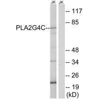 PLA2G4C Antibody (PACO22300)