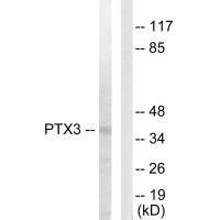 PTX3 Antibody (PACO23212)