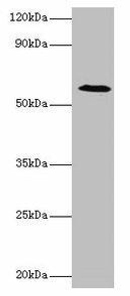 UGP2 Antibody (PACO35618)