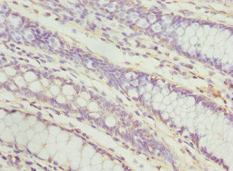 PECR Antibody (PACO44548)