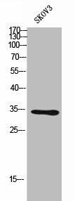 NCR1 Antibody (PACO02263)