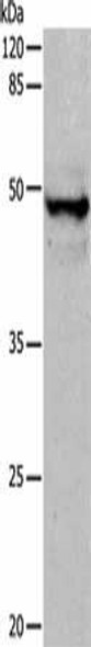 KRT15 Antibody (PACO14053)