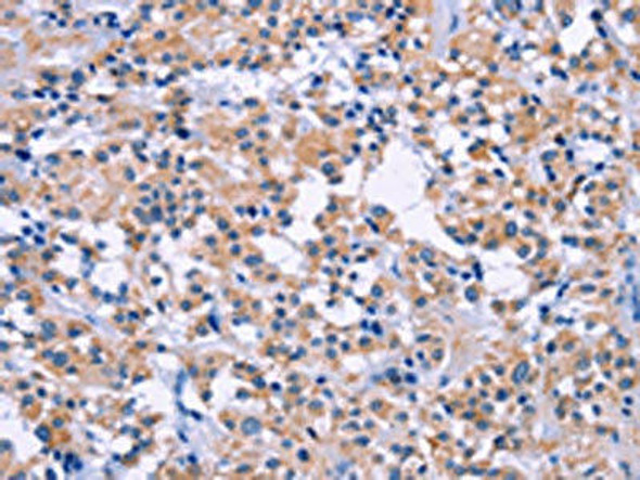 DUSP22 Antibody (PACO14386)