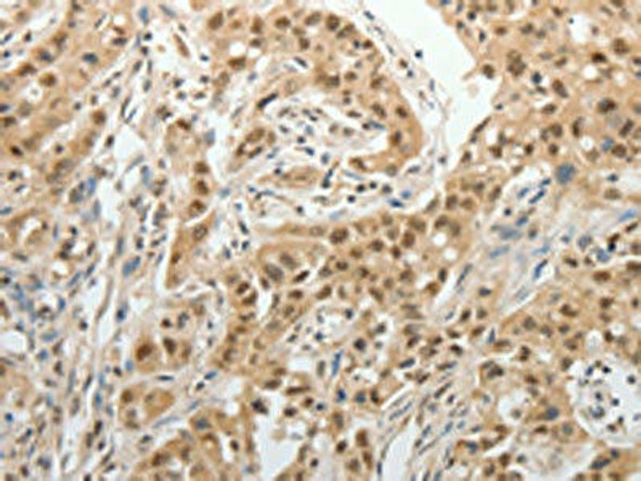 PSMD14 Antibody (PACO14934)