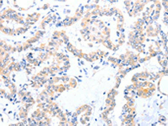 ACAD10 Antibody (PACO15246)