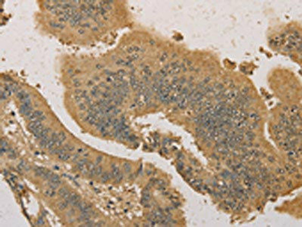 PRDM14 Antibody (PACO15554)