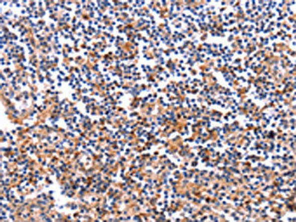 COL20A1 Antibody (PACO16052)