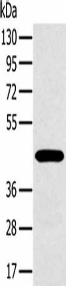 MAGEA10 Antibody (PACO16642)