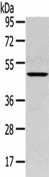 SERPINB11 Antibody (PACO17085)