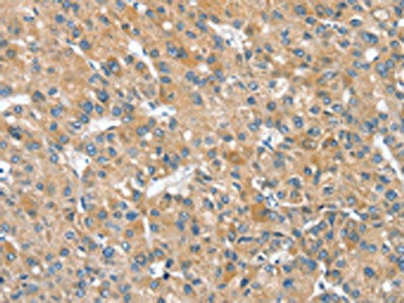 SLC25A2 Antibody (PACO17107)