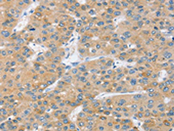 SLC27A2 Antibody (PACO17108)