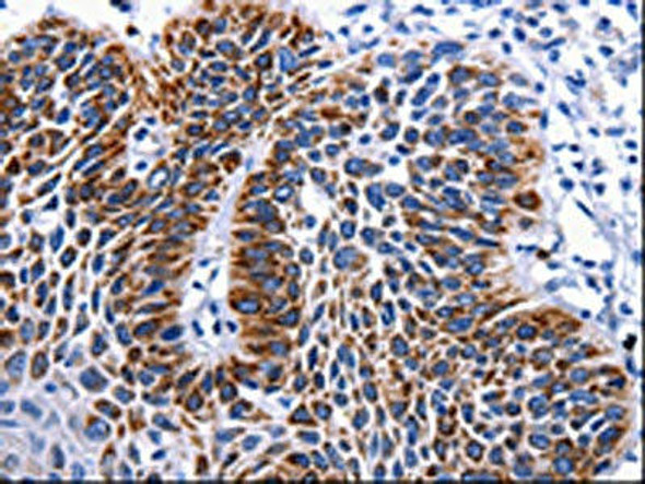 RAB25 Antibody (PACO17509)