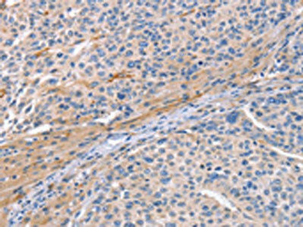 CD59 Antibody (PACO19440)