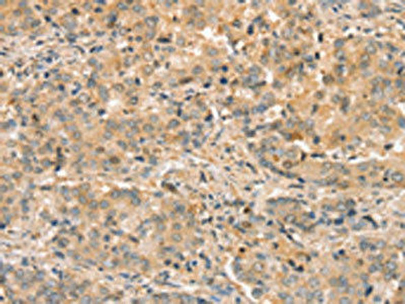 SLC44A2 Antibody (PACO20516)