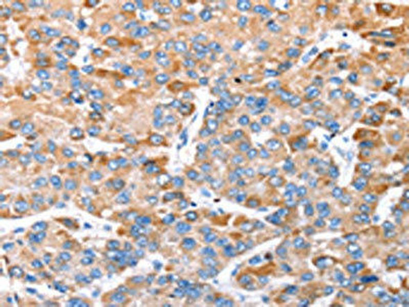 TRIM14 Antibody (PACO20690)