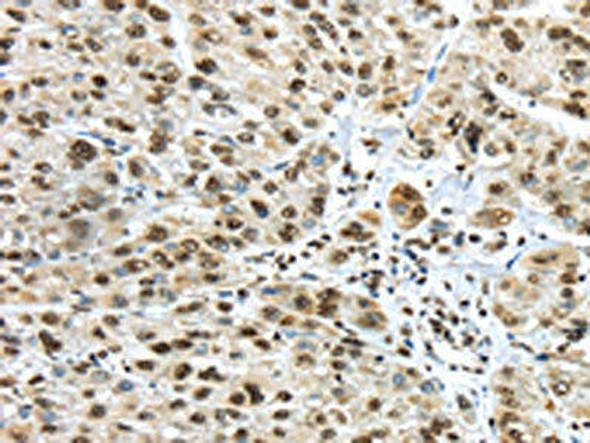 TRIM27 Antibody (PACO20695)