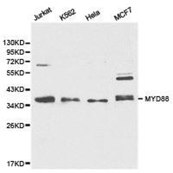 MYD88 Antibody (PACO21060)