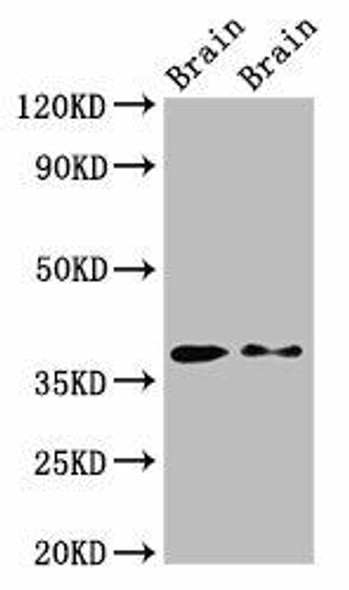 PEX10 Antibody (PACO55722)
