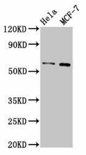 MMP28 Antibody (PACO56194)