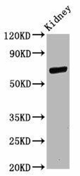 CD2AP Antibody (PACO58701)