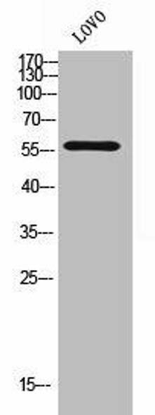 TRIM38 Antibody (PACO02323)