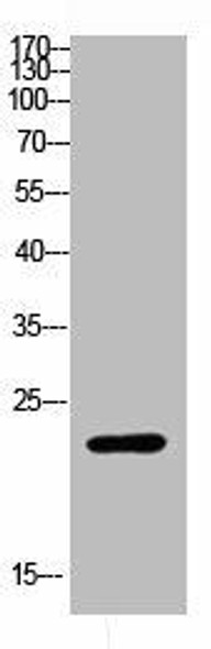 RPL17 Antibody (PACO06797)