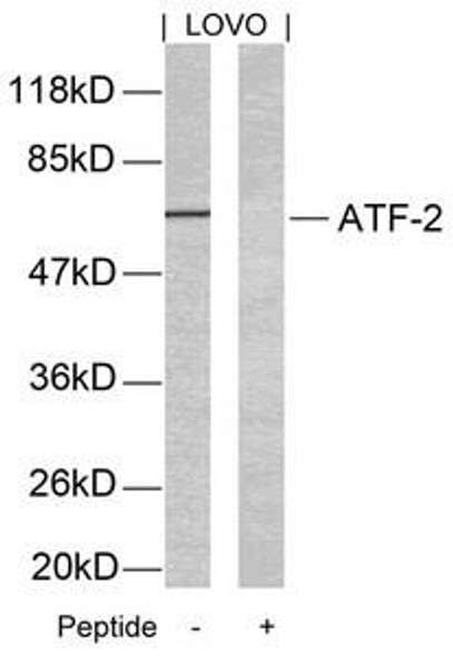 ATF2 (Ab-69 or 51) Antibody (PACO22873)